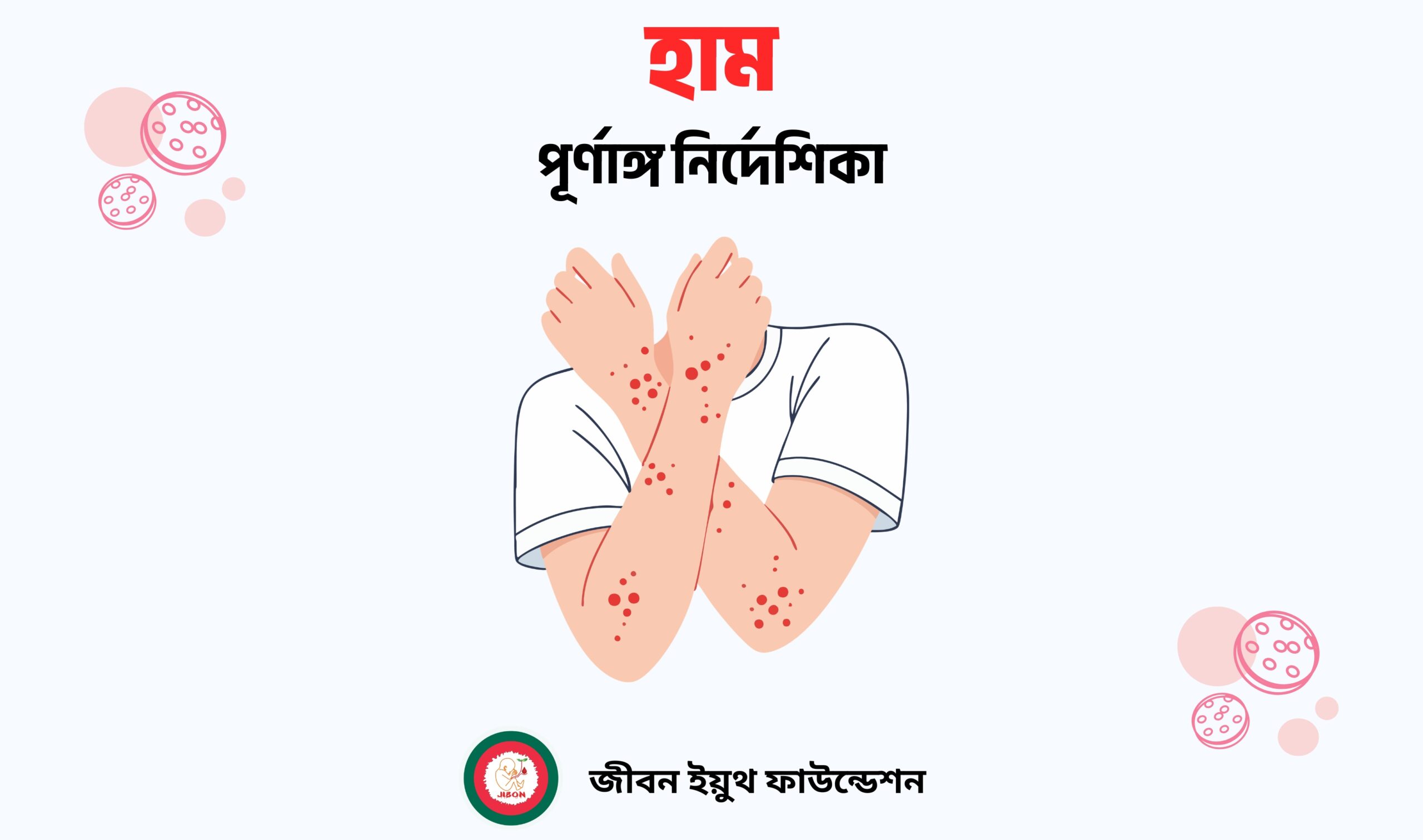 Measles-হাম